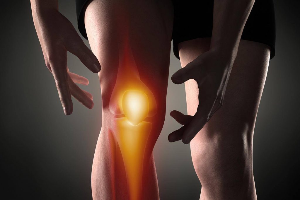 Joint Stiffness knee joint arthritis